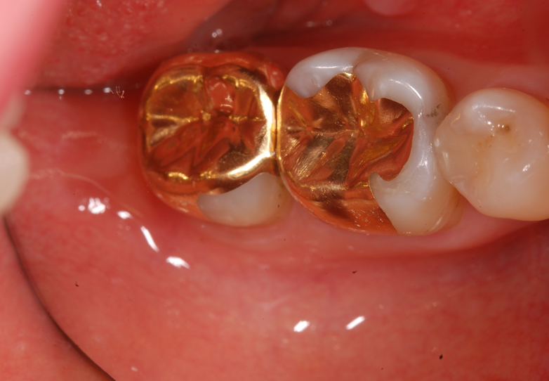 Gallery Cambie Dental Centre Vancouver Dentistry