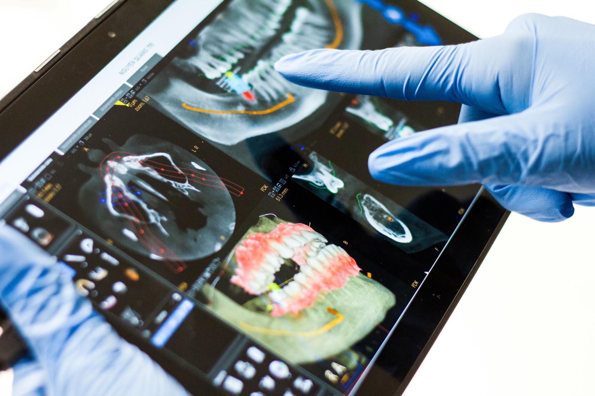 Endodontic care