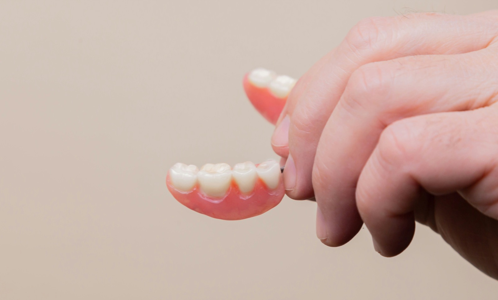 Implant-supported dentures