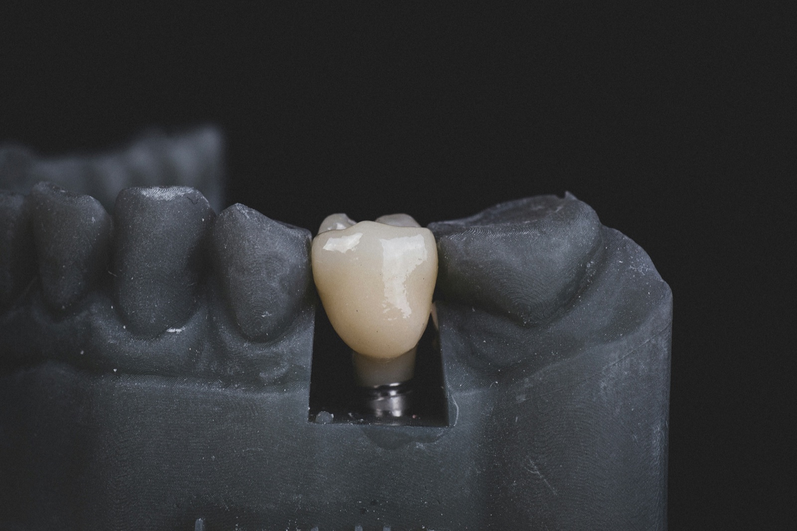Single and multiple dental implants