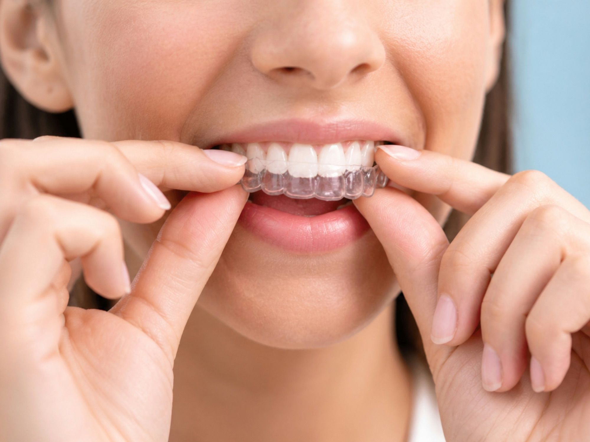 Orthodontic care