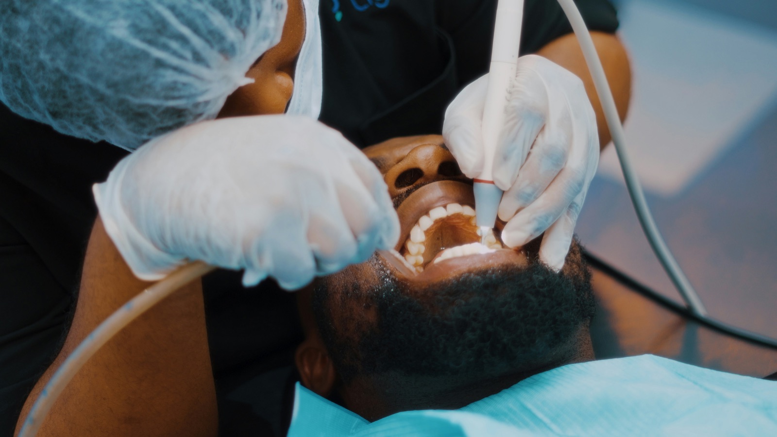 Signs you might need a root canal (and why it is not scary)