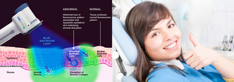 Cambie Dental Oral Cancer Screening